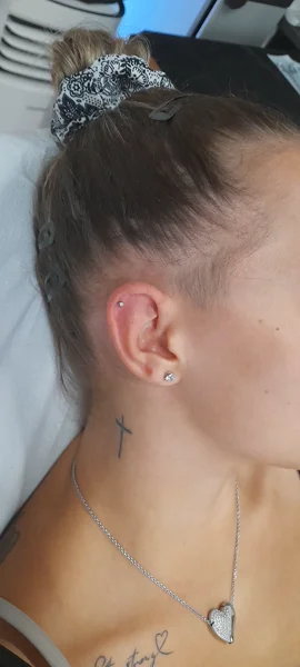 helix