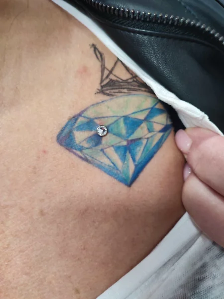 microdermal clavicola
