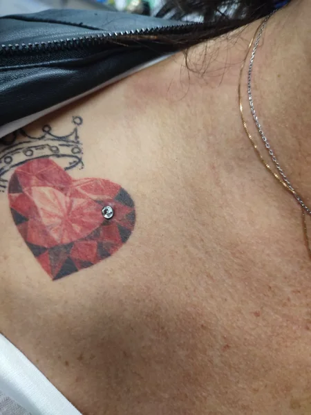 microdermal clavicola