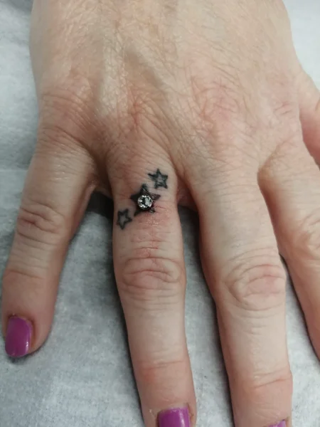 microdermal dito