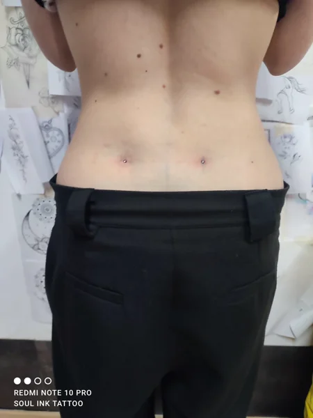 microdermal lombare