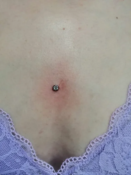 microdermal petto