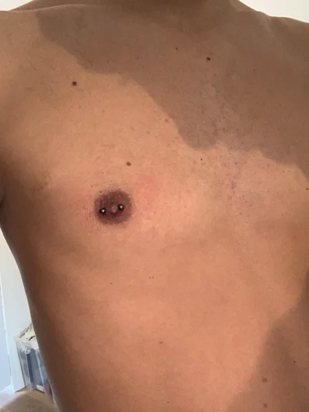 nipple