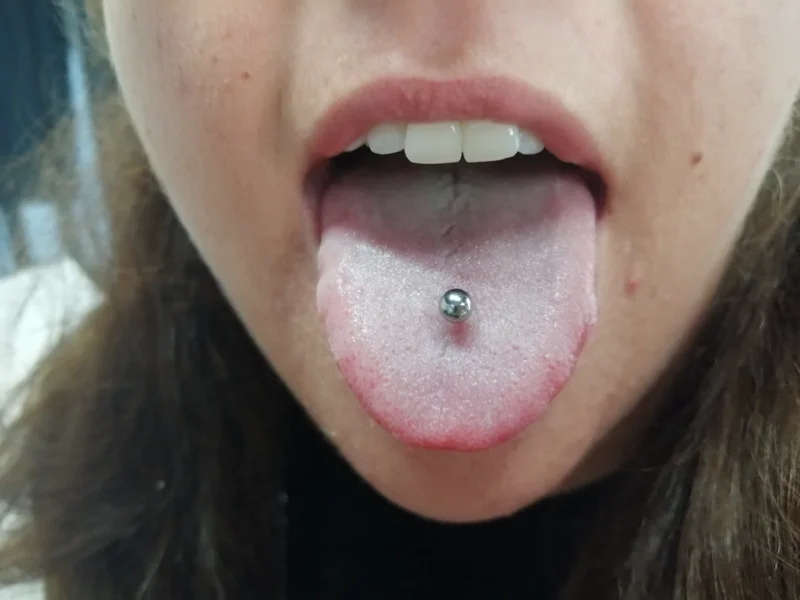 tongue