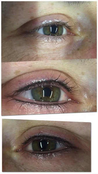 eyeliner infraciliare
