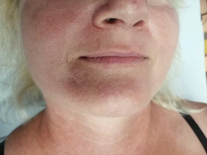 lip prima