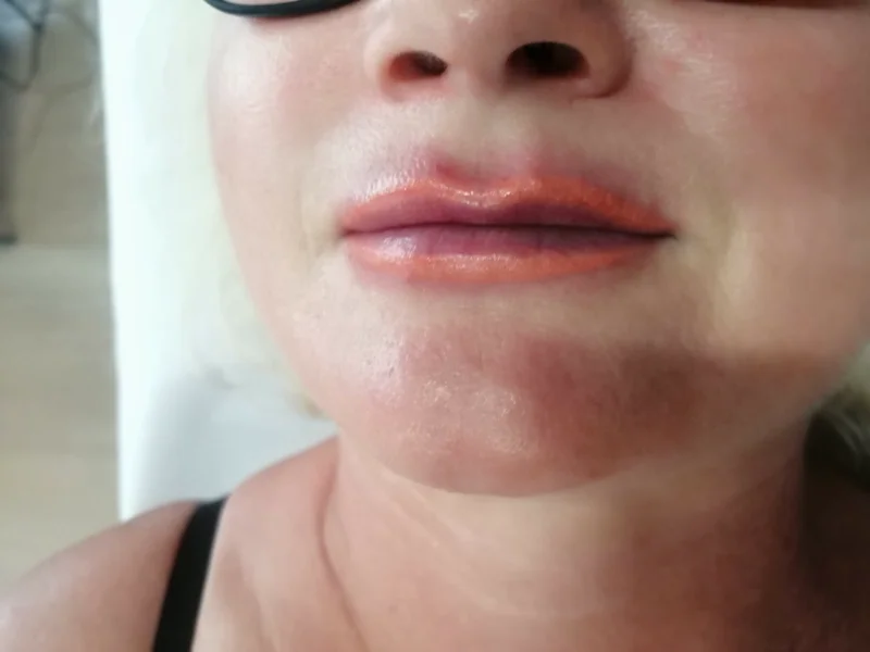 lip naturale