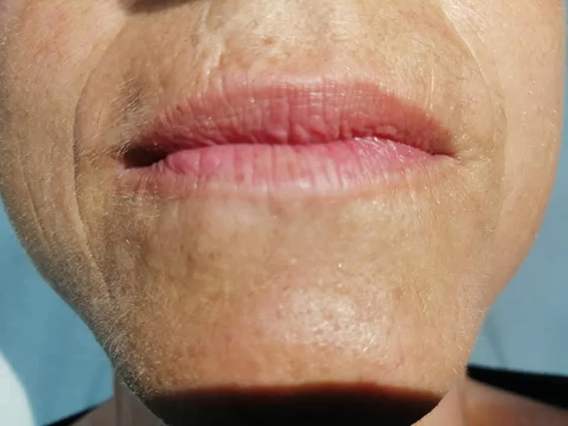 lip