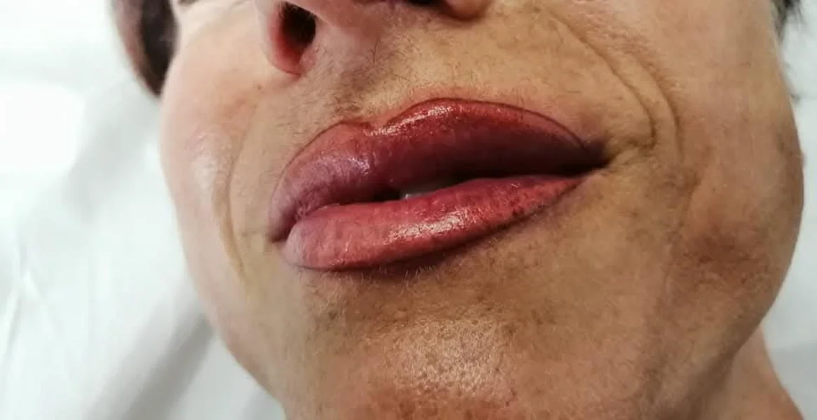 lipcontour
